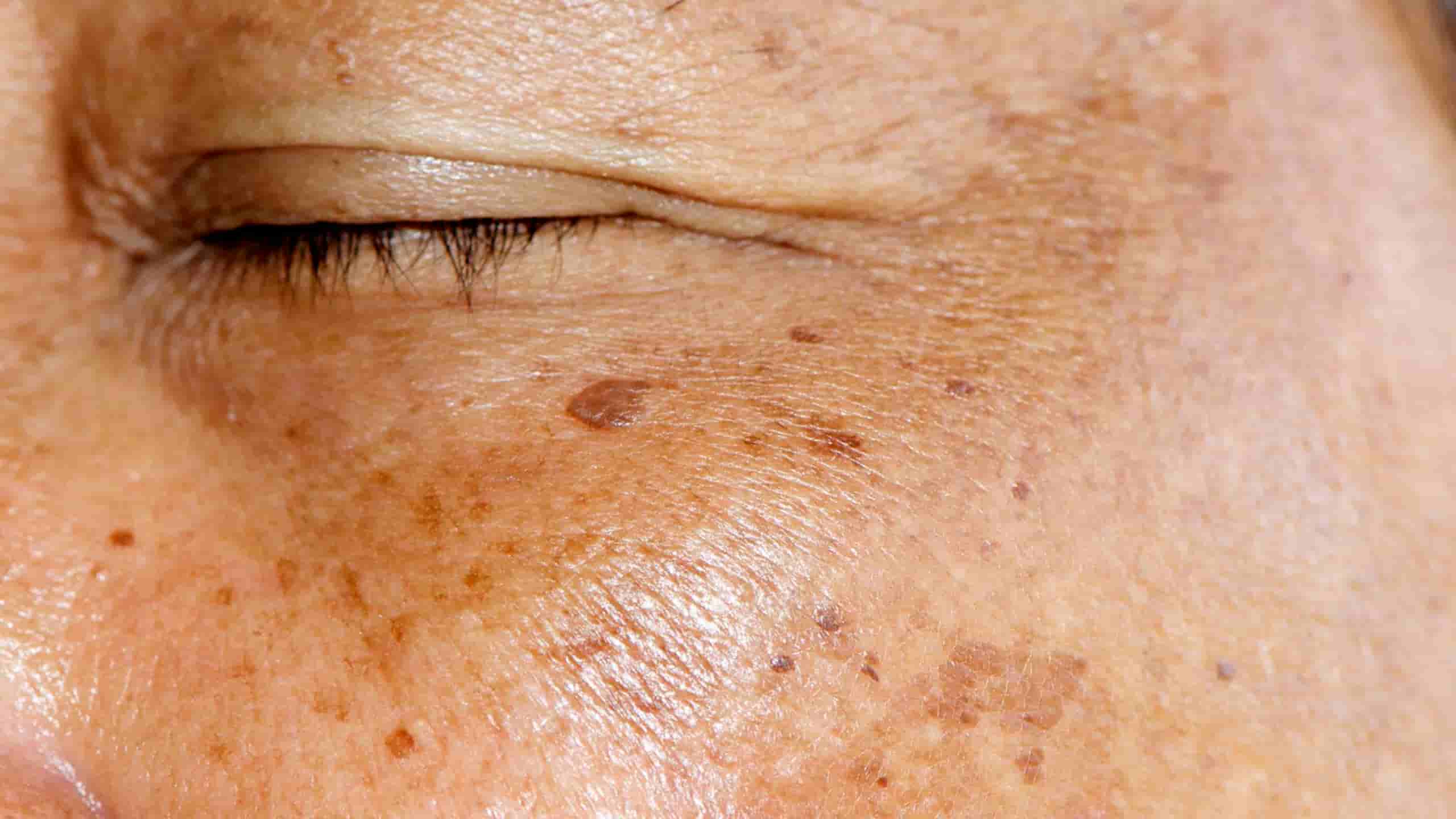 How to Address Your Skincare Concerns at a Skin Clinic in Hobart