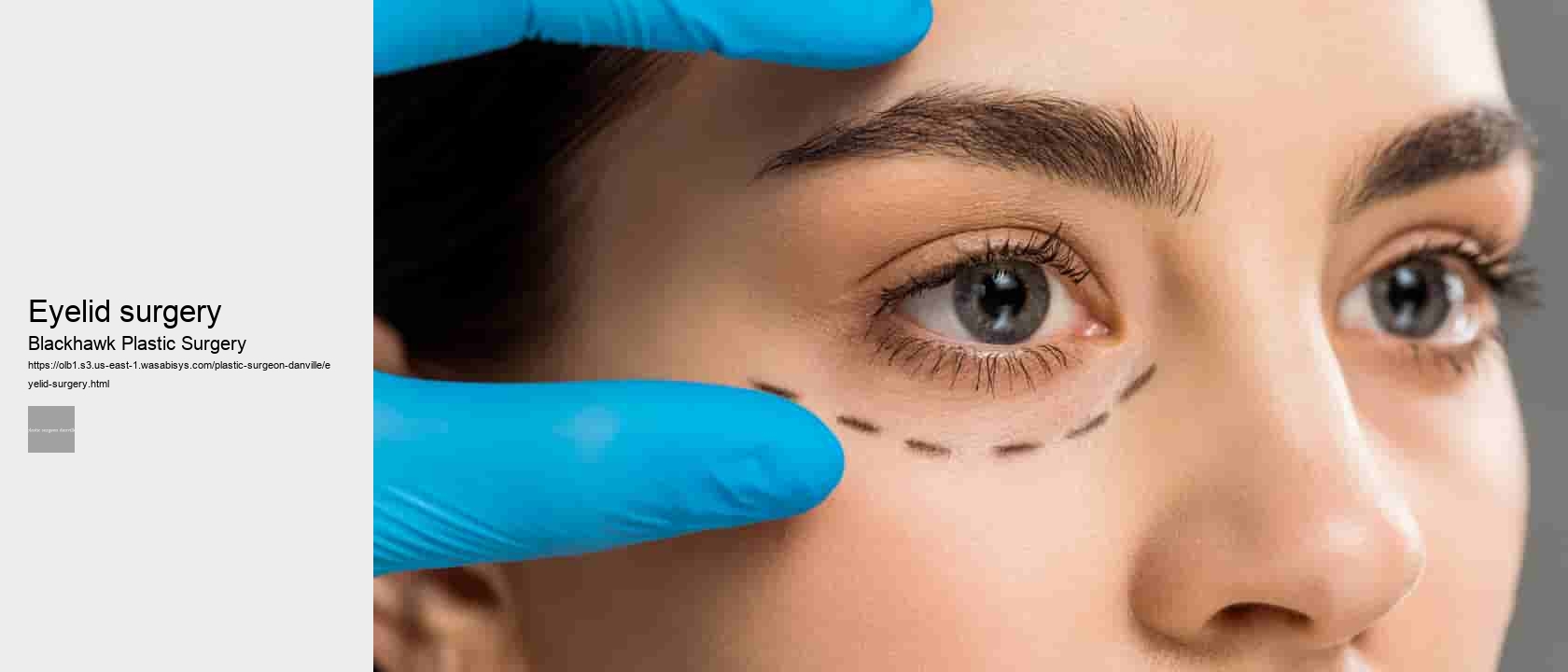 eyelid surgery