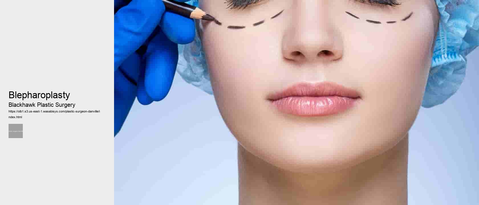 blepharoplasty