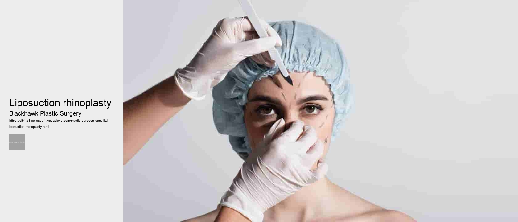 liposuction rhinoplasty